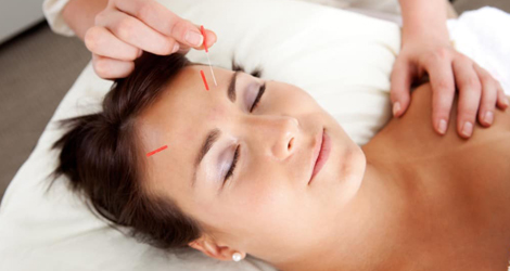 Acupuncture-Treatment